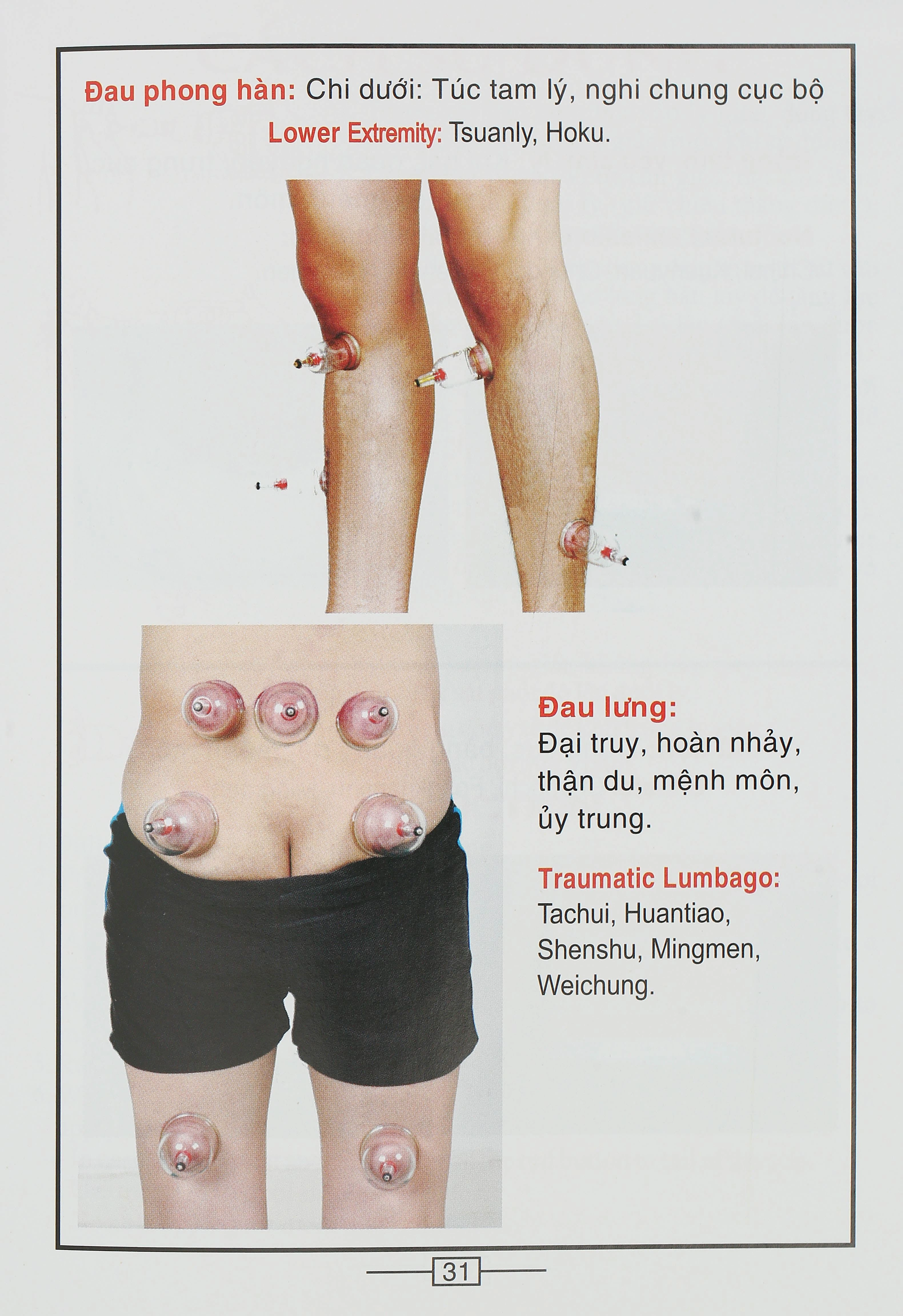 Bộ Giác hơi không dùng lửa Duy Thành YGH01 loại A - 18