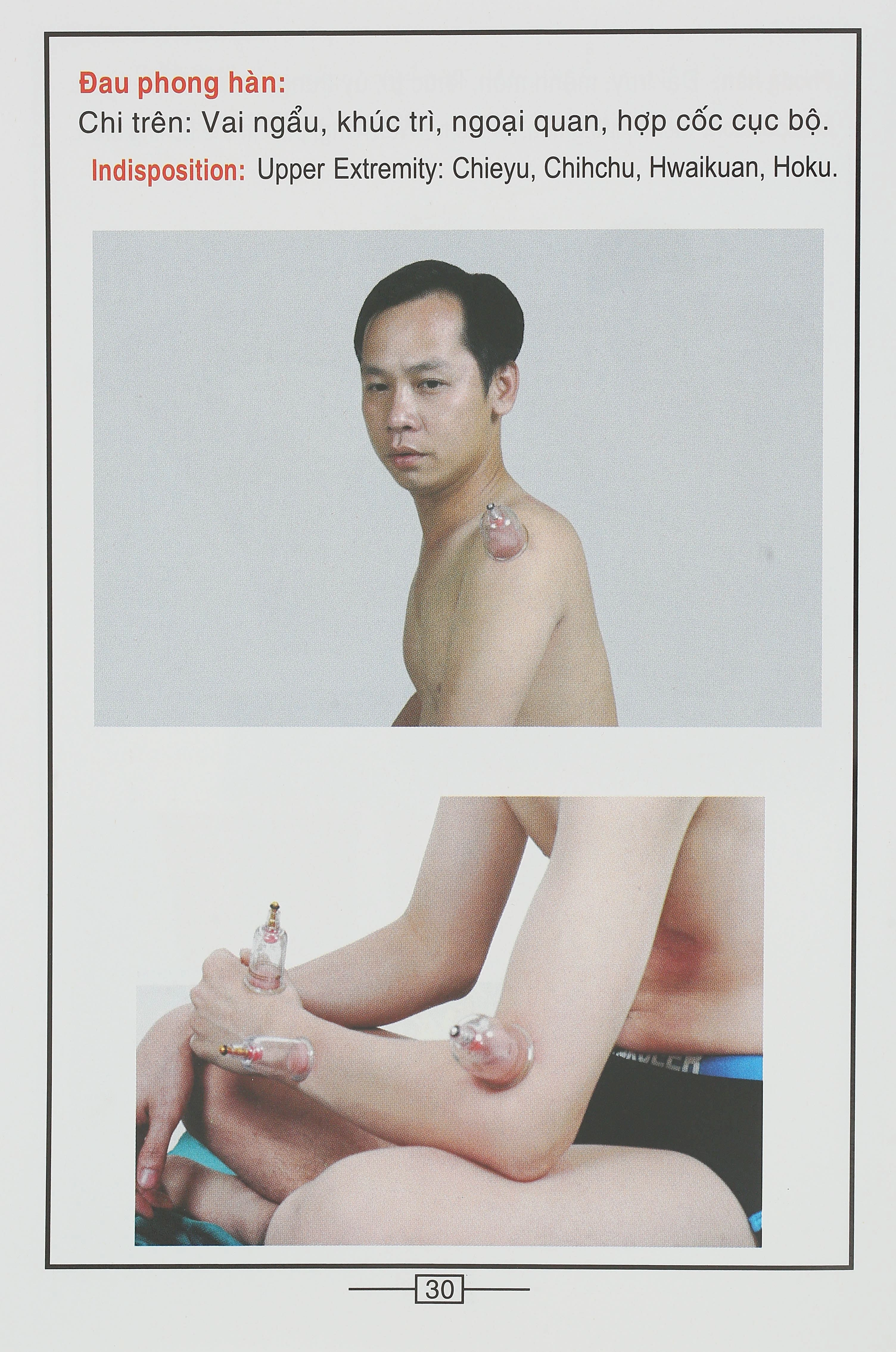 Bộ Giác hơi không dùng lửa Duy Thành YGH01 loại A - 19