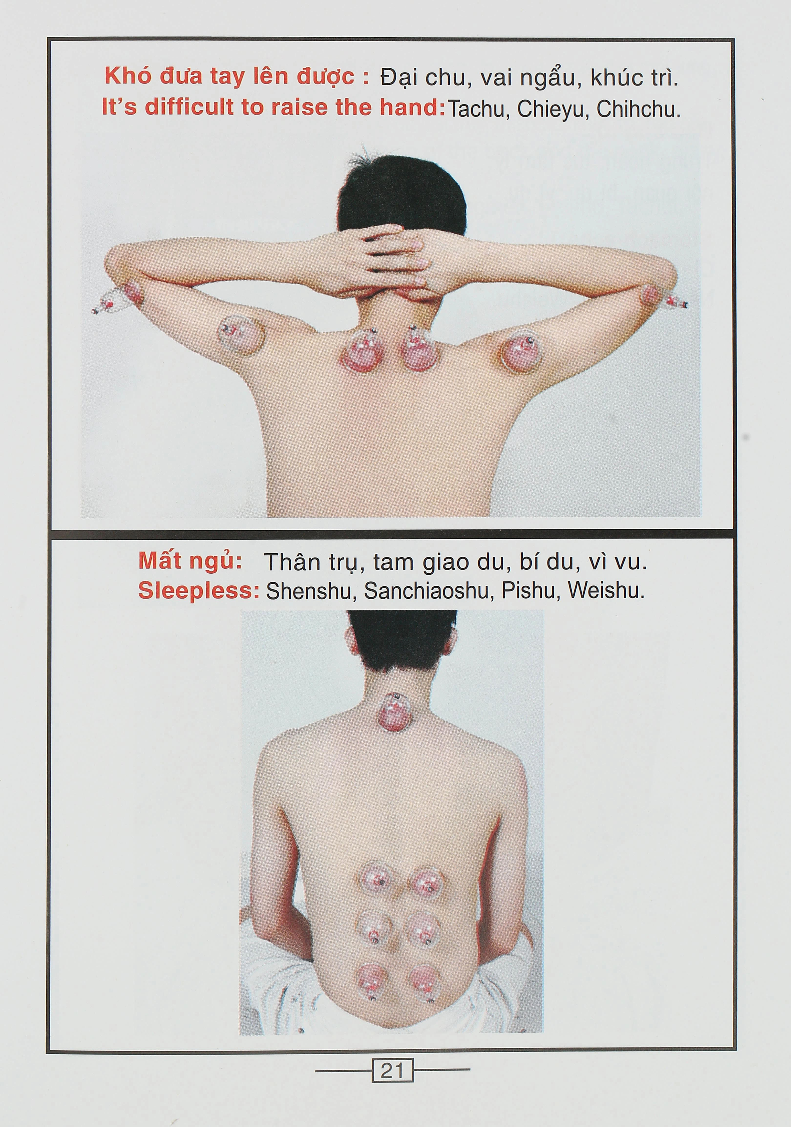 Bộ Giác hơi không dùng lửa Duy Thành YGH01 loại A - 28