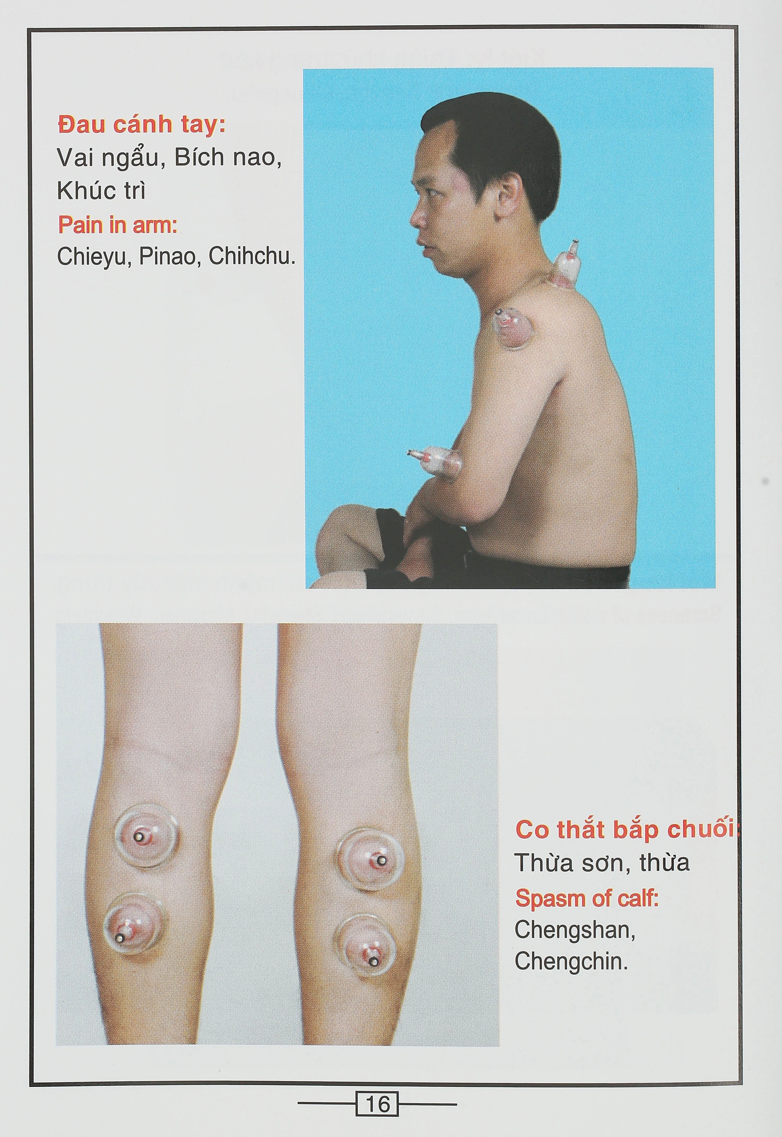 Bộ Giác hơi không dùng lửa Duy Thành YGH01 loại A - 33