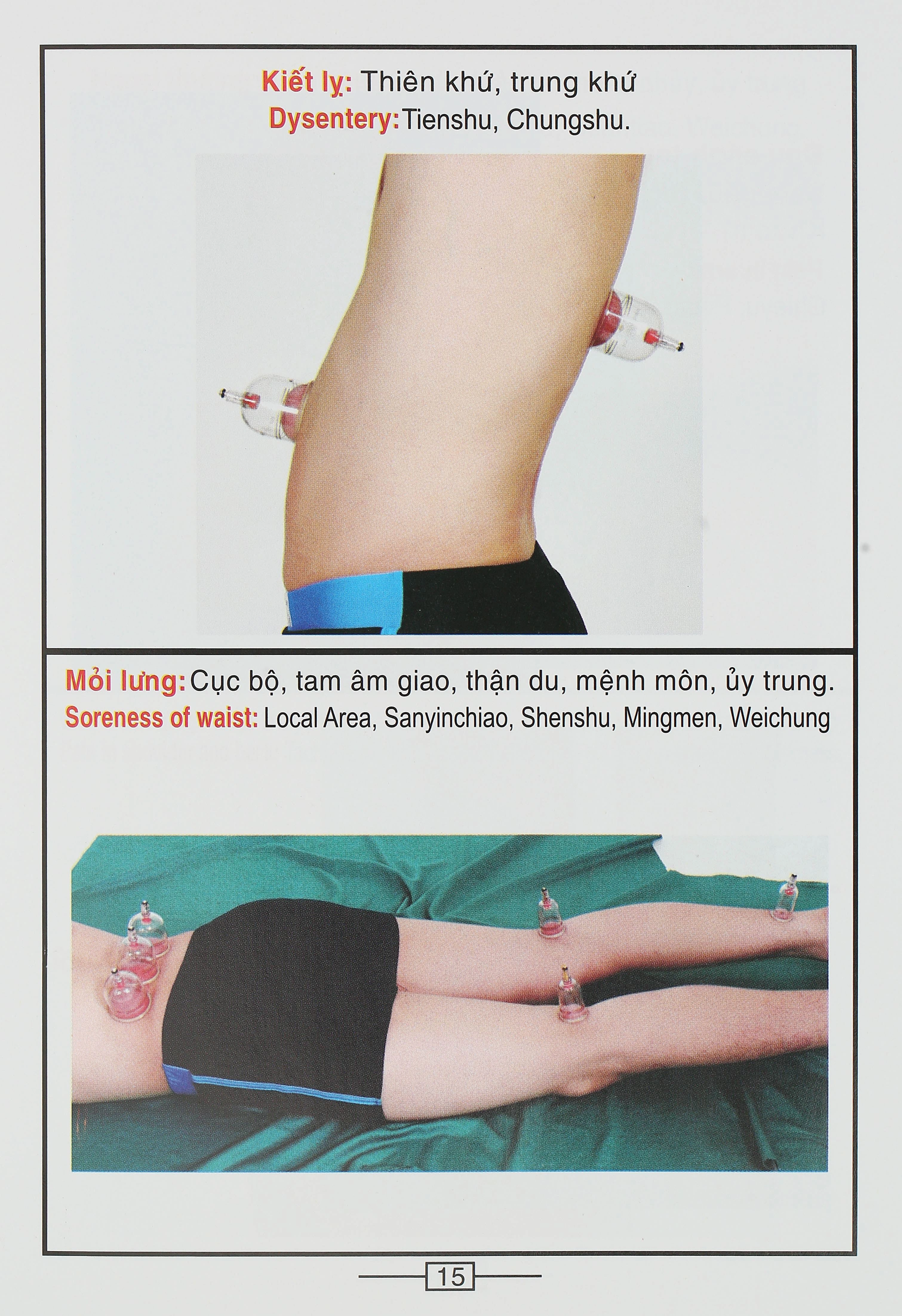 Bộ Giác hơi không dùng lửa Duy Thành YGH01 loại A - 34