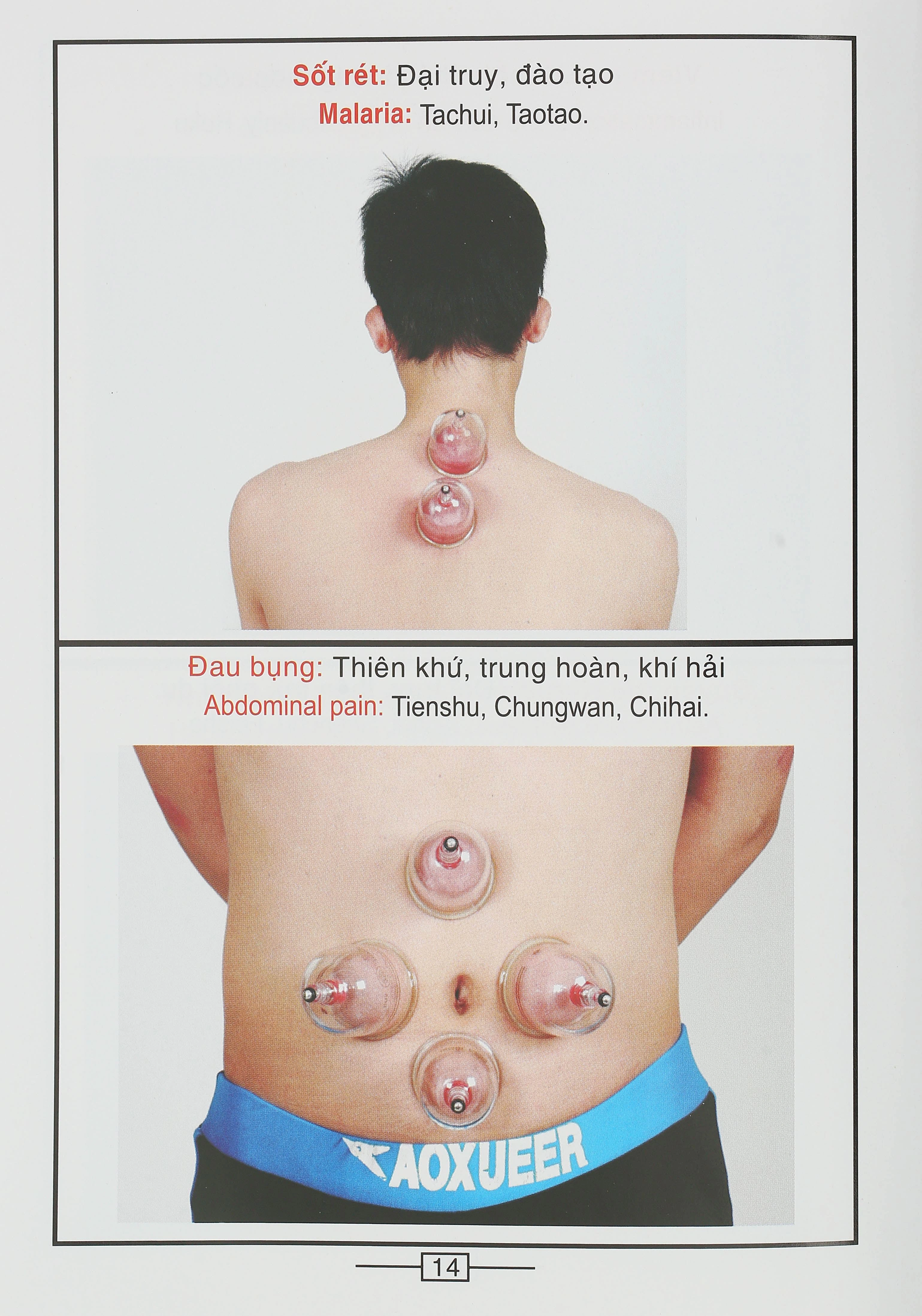 Bộ Giác hơi không dùng lửa Duy Thành YGH01 loại A - 35