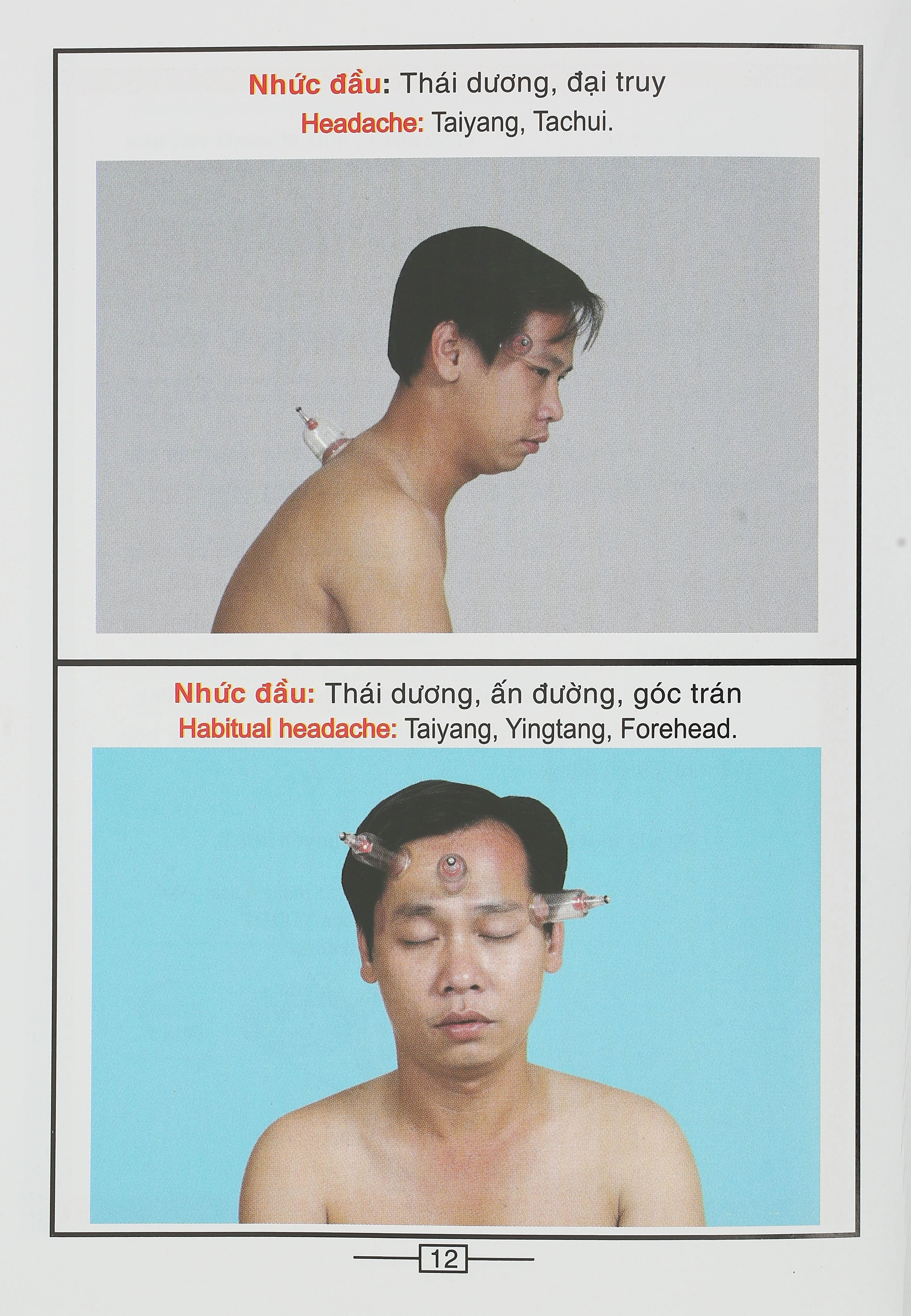 Bộ Giác hơi không dùng lửa Duy Thành YGH01 loại A - 37