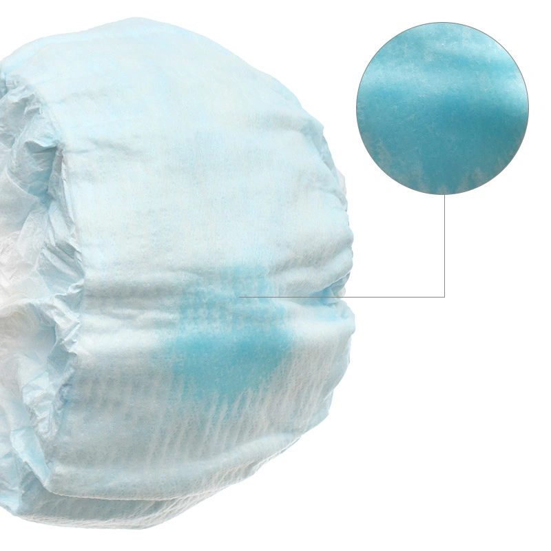 Tã dán Molfix Oxy size M 76 miếng (6 - 11 kg) 11