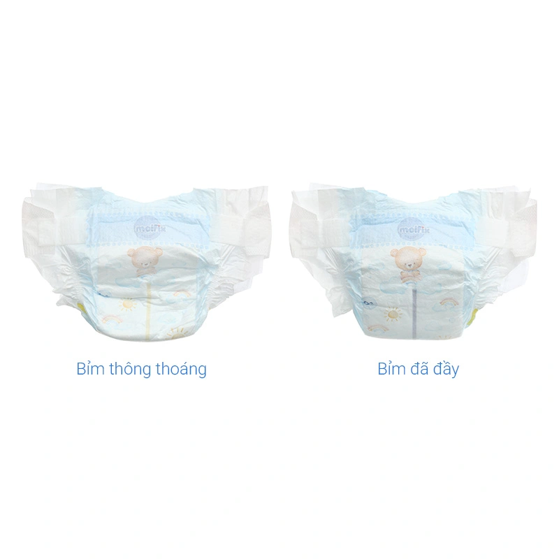 Tã dán Molfix Oxy size M 76 miếng (6 - 11 kg) 25