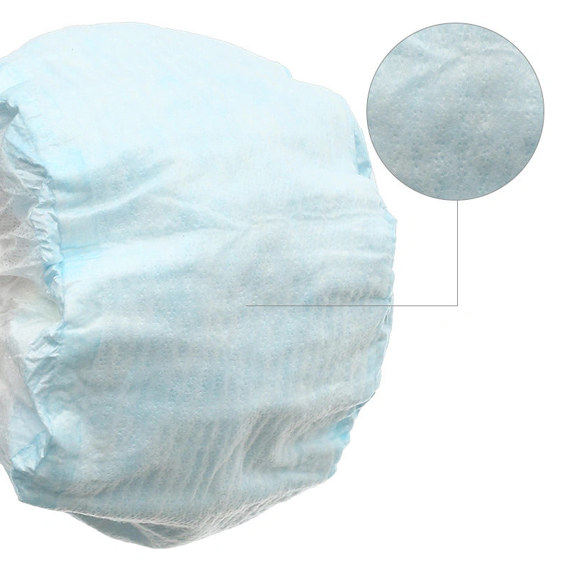 Tã dán Molfix Oxy size M 76 miếng (6 - 11 kg) 36