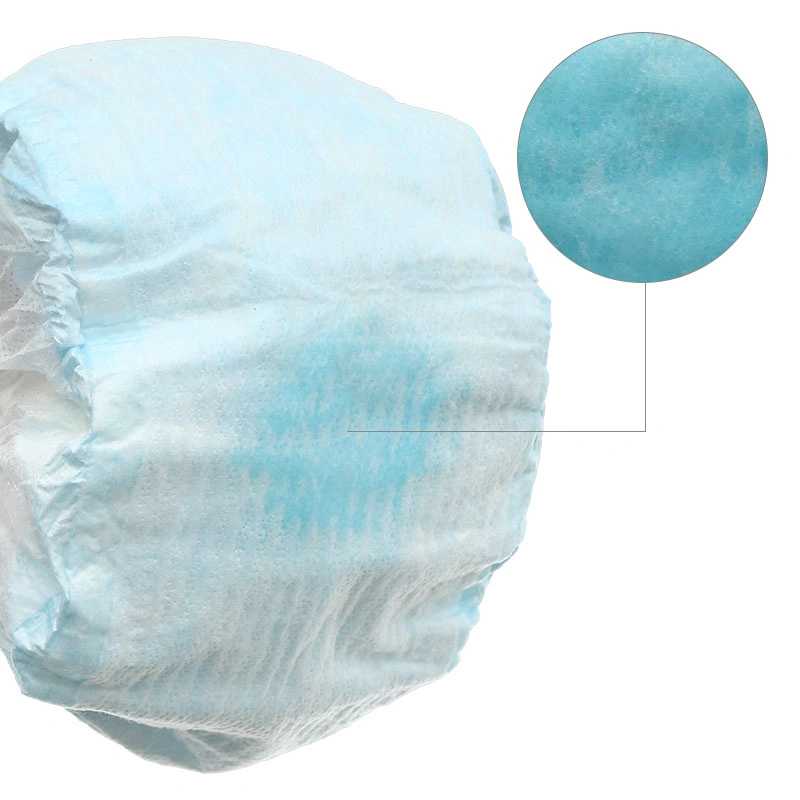 Tã dán Molfix Oxy size M 76 miếng (6 - 11 kg) 37