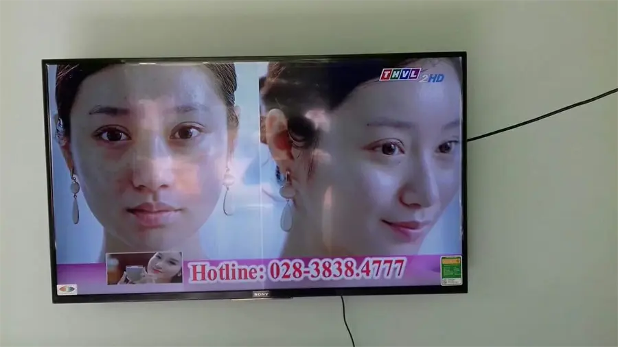 Khách hàng review Android Tivi Sony 43 inch KDL-43W800F 16