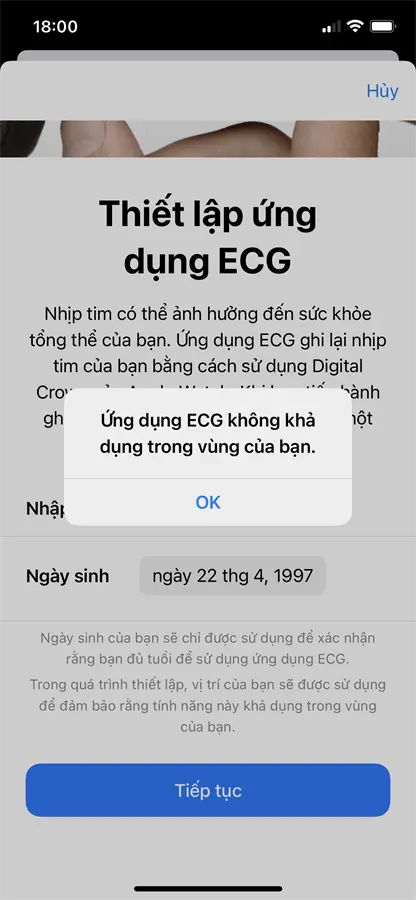 Khách hàng review Đồng hồ thông minh Apple Watch S6 44mm 7