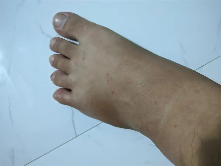Khách hàng review Đèn diệt côn trùng đa năng Comet CM069 9