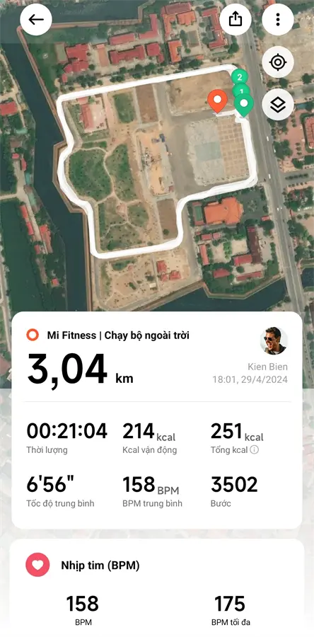 Khách hàng review Vòng đeo tay thông minh Mi Band 8 Pro 6
