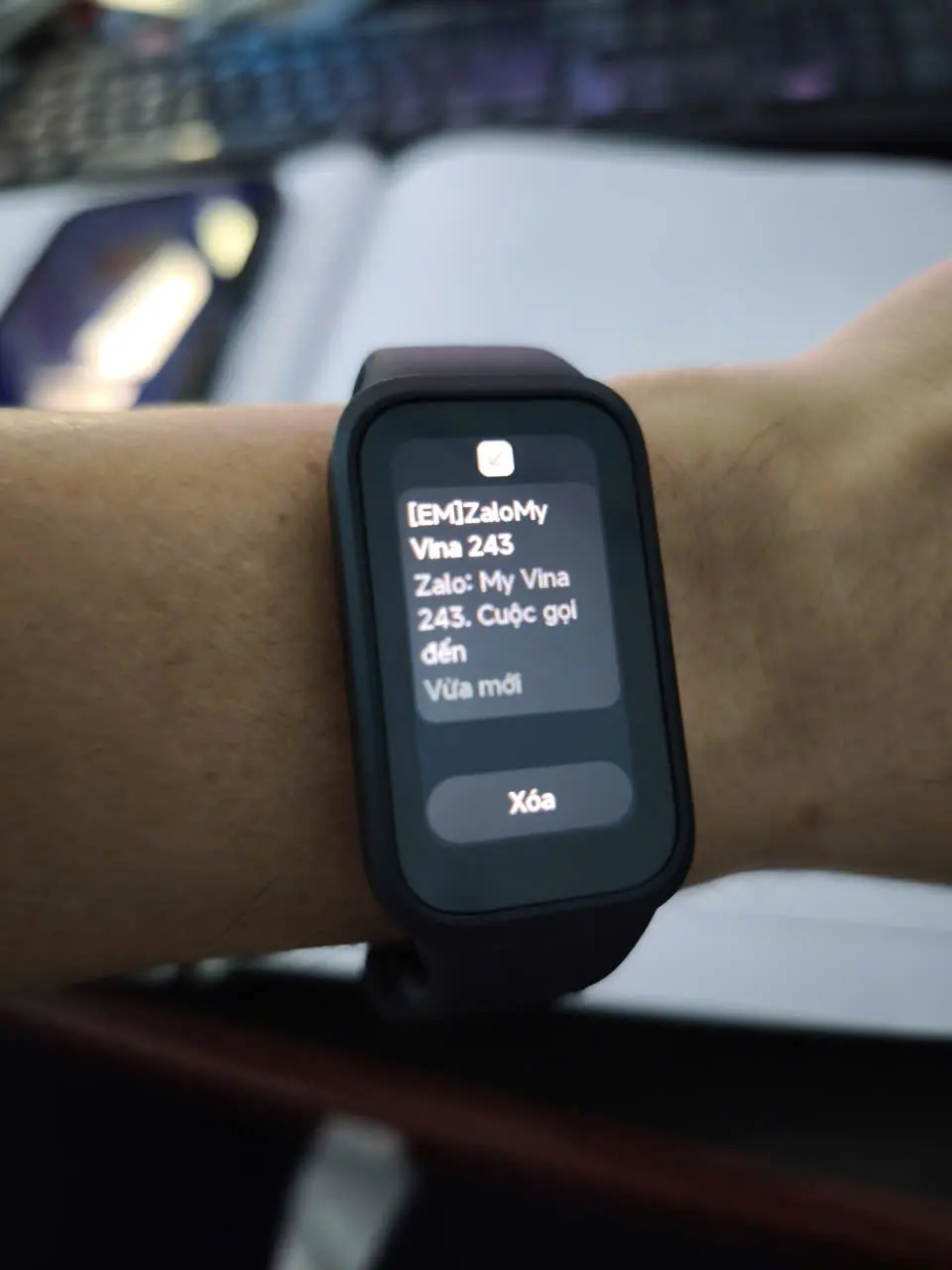 Khách hàng review Vòng đeo tay thông minh Mi Band 9 Active 1